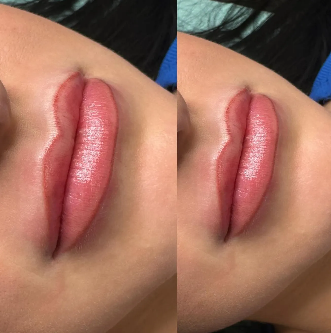 Popular Treatments and Options