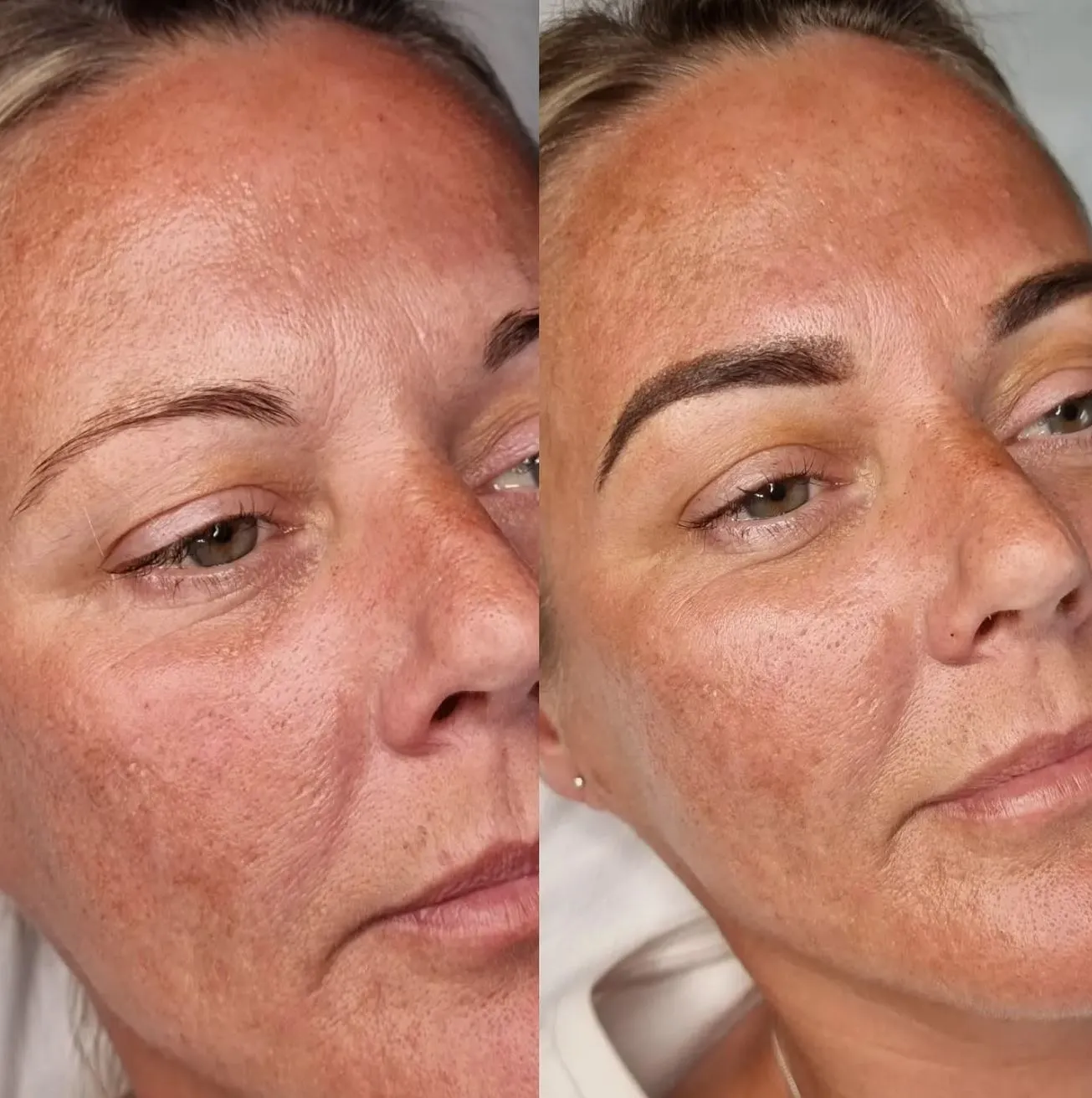 Touch-Up Appointments and Long-Term Maintenance